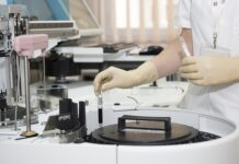 Czy pracownik ma obowiązek zgłaszania każdego wypadku przy pracy?